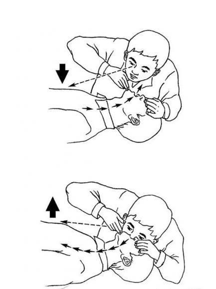 心肺復蘇  意外呼吸心跳驟停三個搶救步驟