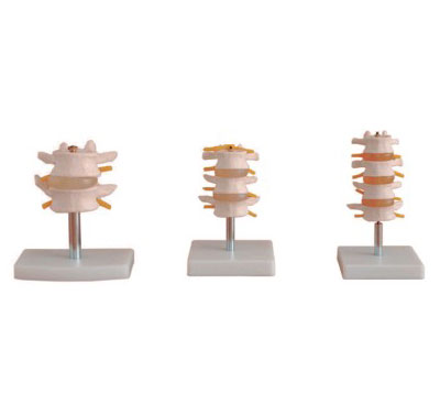 正常腰椎組合 （二節(jié)、三節(jié)、四節(jié)）